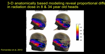 3-d anatomically based modeling picture reveal proportional difference in radiation dose in 8 & 34 year old heads