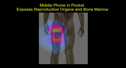 mobile phone in pocket exposes reproductive organs and bone marrow