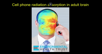 cell phone radiation absorption in adult brain